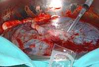 placenta.jpg