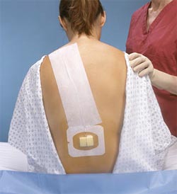 anestesia-epidural01.jpg