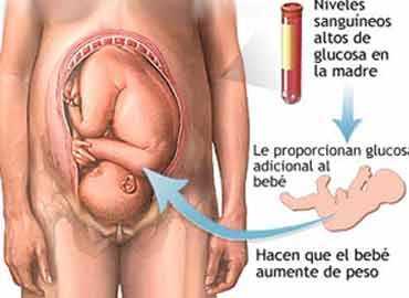 diabetes-pregestional